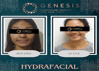 Genesis-dermatology-Dermatologist-doctors-Chennai-Tamil-nadu-2