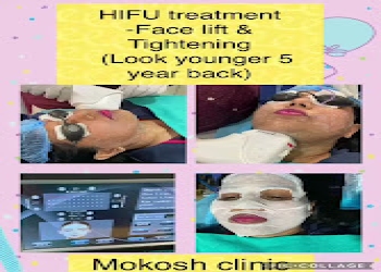 Mokosh-dermatology-clinic-Dermatologist-doctors-Chinhat-lucknow-Uttar-pradesh-1