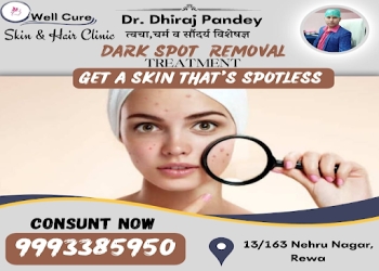 Well-cure-skin-and-hair-clinic-Dermatologist-doctors-Rewa-Madhya-pradesh-1